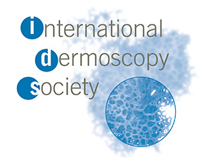 WCD 2021 VIRTUAL - The first Virtual World Congress of Dermoscopy / Virtual